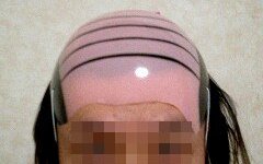ハゲヅラ